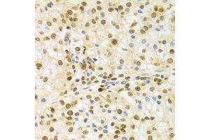 Image no. 15 for anti-ELAV (Embryonic Lethal, Abnormal Vision, Drosophila)-Like 1 (Hu Antigen R) (ELAVL1) antibody (ABIN3022231)