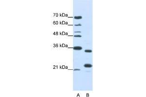 Image no. 1 for anti-AlkB, Alkylation Repair Homolog 8 (ALKBH8) (N-Term) antibody (ABIN2776625)