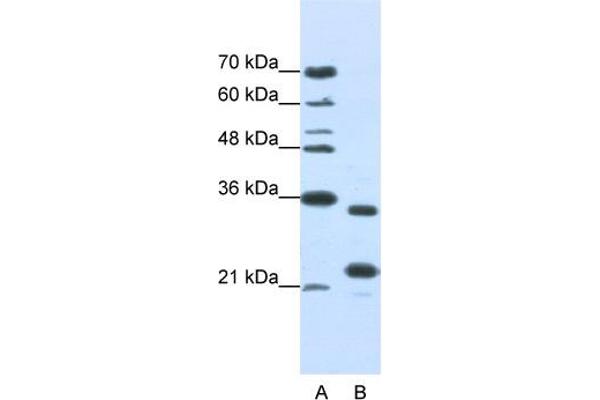 anti-AlkB, Alkylation Repair Homolog 8 (ALKBH8) (N-Term) antibody