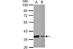 Image no. 1 for anti-Heat Shock Transcription Factor 2 Binding Protein (HSF2BP) (Center) antibody (ABIN2855677)