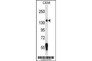 Image no. 1 for anti-Splicing Factor 3b, Subunit 3, 130kDa (SF3B3) (AA 1046-1074), (C-Term) antibody (ABIN656631)