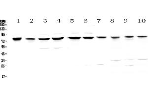 Image no. 4 for anti-Poly A Specific Ribonuclease (PARN) (AA 1-301) antibody (ABIN5693032)