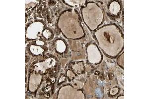 GMEB2 antibody