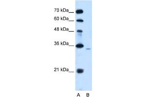 Image no. 1 for anti-Phosphatidic Acid Phosphatase Type 2A (PPAP2A) (Middle Region) antibody (ABIN2777163)