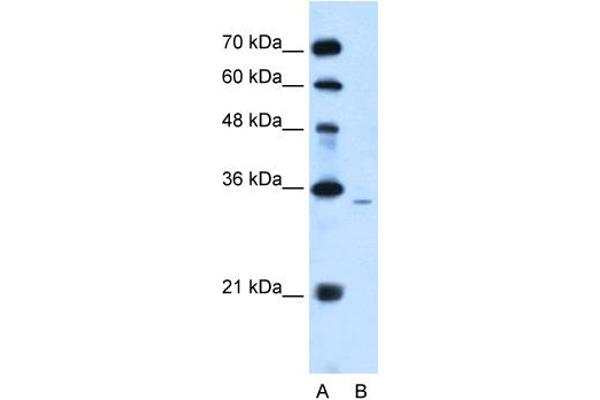 PPAP2A Antikörper  (Middle Region)