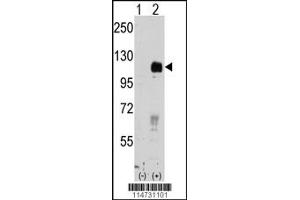 Western Blotting (WB) image for anti-EPH Receptor B4 (EPHB4) antibody (ABIN2158724)