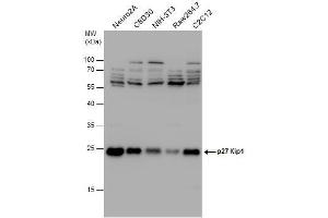 Image no. 1 for anti-Cyclin-Dependent Kinase Inhibitor 1B (p27, Kip1) (CDKN1B) (Center) antibody (ABIN2854753)