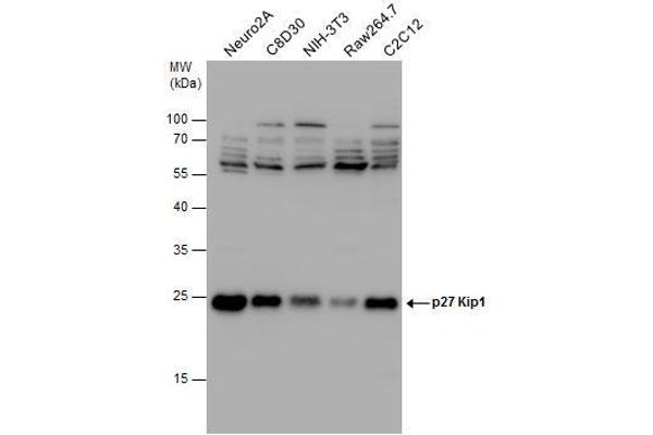 anti-Cyclin-Dependent Kinase Inhibitor 1B (p27, Kip1) (CDKN1B) (Center) antibody