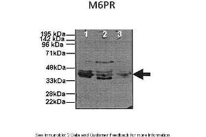 Image no. 2 for anti-Mannose-6-Phosphate Receptor (Cation Dependent) (M6PR) (N-Term) antibody (ABIN2781302)