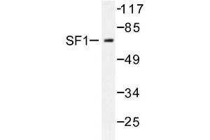 Image no. 1 for anti-Nuclear Receptor Subfamily 5, Group A, Member 1 (NR5A1) antibody (ABIN272078)