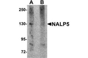Image no. 1 for anti-NLR Family, Pyrin Domain Containing 5 (NLRP5) (C-Term) antibody (ABIN783707)