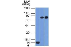 p63 anticorps  (AA 3-106)