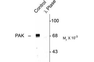 Image no. 1 for anti-P21-Activated Kinases 1/2/3 (PAK1/2/3) (pThr423) antibody (ABIN472196)