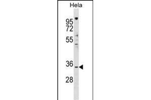 IACT Antibody (N-term) (ABIN1538830 and ABIN2849149) western blot analysis in Hela cell line lysates (35 μg/lane).