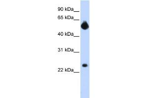 Image no. 2 for anti-Notch 4 (NOTCH4) (Middle Region) antibody (ABIN2779440)