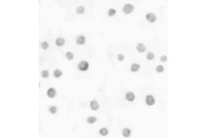 Image no. 2 for anti-ATP-Binding Cassette, Sub-Family A (ABC1), Member 7 (ABCA7) (N-Term) antibody (ABIN6655280)