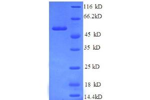 Image no. 1 for Replication Protein A2, 32kDa (RPA2) (AA 1-267), (partial) protein (GST tag) (ABIN1608311)