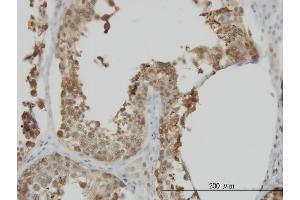 Image no. 2 for anti-Heat Shock 70kDa Protein 1-Like (HSPA1L) (AA 561-641) antibody (ABIN561381)