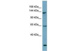 Image no. 1 for anti-LATS, Large Tumor Suppressor, Homolog 1 (Drosophila) (LATS1) (AA 971-1020) antibody (ABIN6741908)