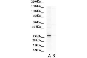 Image no. 4 for anti-Aspartate beta-Hydroxylase (ASPH) (N-Term) antibody (ABIN2784532)