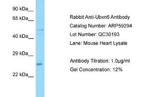 Image no. 1 for anti-UBX Domain Protein 6 (UBXN6) (Middle Region) antibody (ABIN2788011)