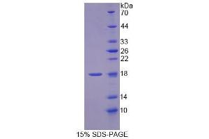Image no. 1 for Methylmalonyl CoA Epimerase (MCEE) protein (ABIN6119623)