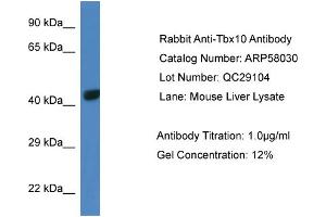 Image no. 1 for anti-T-Box 10 (TBX10) (Middle Region) antibody (ABIN2787521)