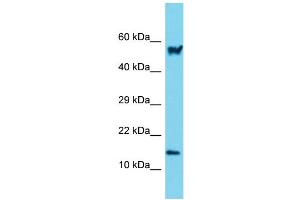Image no. 1 for anti-Actin Related Protein 2/3 Complex, Subunit 5, 16kDa (ARPC5) (N-Term) antibody (ABIN2790140)