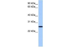 Image no. 1 for anti-F-Box Protein 36 (FBXO36) (N-Term) antibody (ABIN632357)
