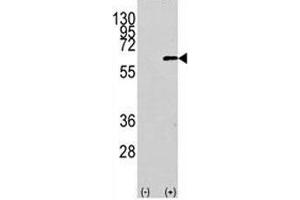 Image no. 3 for anti-V-Akt Murine Thymoma Viral Oncogene Homolog 1 (AKT1) (AA 115-144) antibody (ABIN3029459)