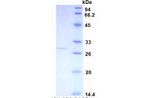Image no. 3 for C-Reactive Protein (CRP) ELISA Kit (ABIN6574108)