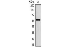 Image no. 2 for anti-CD2 (Cytoplasmic Tail) Binding Protein 2 (CD2BP2) (Center) antibody (ABIN2705785)