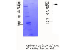 Image no. 2 for Cadherin 20 (CDH20) (AA 60-619) protein (MBP tag) (ABIN3090632)