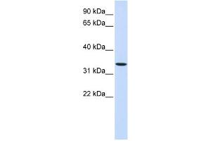 Image no. 1 for anti-Wingless-Type MMTV Integration Site Family, Member 6 (WNT6) (Middle Region) antibody (ABIN2782719)