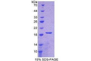Image no. 1 for Superoxide Dismutase 1, Soluble (SOD1) (AA 2-153) protein (His tag) (ABIN1080854)