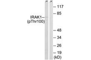 Western blot analysis of extracts from Jurkat cells treated with heat shock, using IRAK1 (Phospho-Thr100) Antibody.