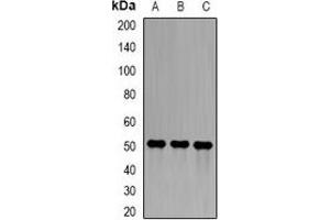 Image no. 2 for anti-Sarcoglycan, epsilon (SGCE) antibody (ABIN2966608)