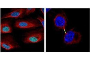 ICC/IF Image Confocal immunofluorescence analysis (Olympus FV10i) of paraformaldehyde-fixed U2OS, using Survivin, antibody (Geen) at 1:500 dilution.