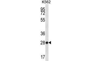 ZNF146 antibody  (N-Term)