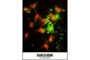 Image no. 2 for anti-Signal Recognition Particle 72kDa (SRP72) (Center) antibody (ABIN2503597)