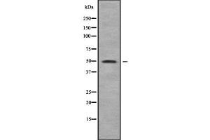 Image no. 1 for anti-Eukaryotic Translation Initiation Factor 5 (EIF5) (C-Term) antibody (ABIN6261502)