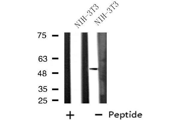 anti-Dual Specificity Phosphatase 10 (DUSP10) (Internal Region) antibody