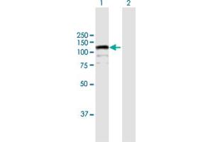 Image no. 1 for anti-CDKN1A Interacting Zinc Finger Protein 1 (CIZ1) (AA 1-818) antibody (ABIN949151)