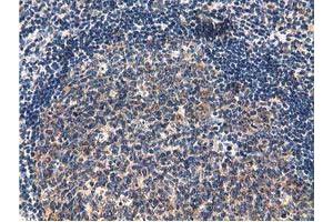 Immunohistochemical staining of paraffin-embedded Human lymph node tissue using anti-CBWD1 mouse monoclonal antibody.