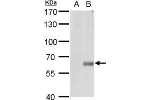 WB Image Copine I antibody [N1N3] detects Copine I protein by western blot analysis.
