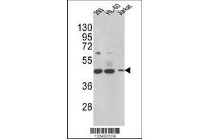Image no. 1 for anti-Hydroxysteroid (17-Beta) Dehydrogenase 7 (HSD17B7) (AA 57-85), (N-Term) antibody (ABIN390725)