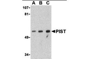 Image no. 1 for anti-Golgi-Associated PDZ and Coiled-Coil Motif Containing (GOPC) (Middle Region) antibody (ABIN1031039)