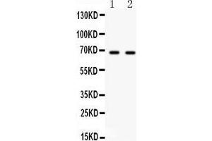 Image no. 2 for anti-Polo-Like Kinase 1 (PLK1) (AA 86-430) antibody (ABIN3043354)