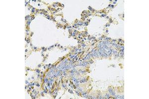 UBE2B antibody  (AA 1-152)