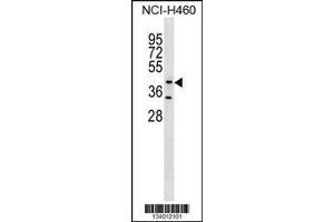 Image no. 1 for anti-Glycosyltransferase 8 Domain Containing 1 (GLT8D1) (AA 338-366), (C-Term) antibody (ABIN1537163)